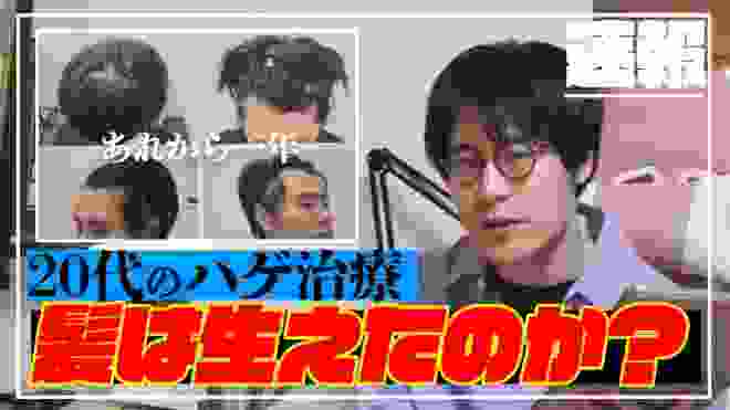 【ハゲ日記】AGA治療を1年続けてみて効果はあったのか？結果と注意点【10代・20代】