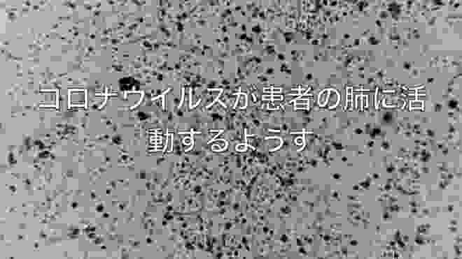 火神山隔離病院は「患者殺処分」施設!?毎日行方不明。日系企業が社員に配るマスクを「強制徴用」した中国政府。「コロナウイルスの隠蔽技まるでプロの殺し屋」２月１２日午前中のまとめ　＃コロナウイルス