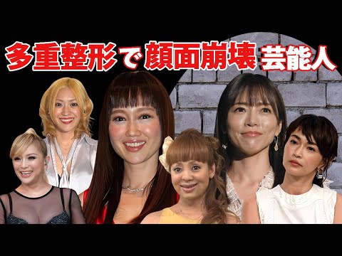 多重整形で顔面崩壊した女性芸能人・有名人１３選【※恐怖画像】