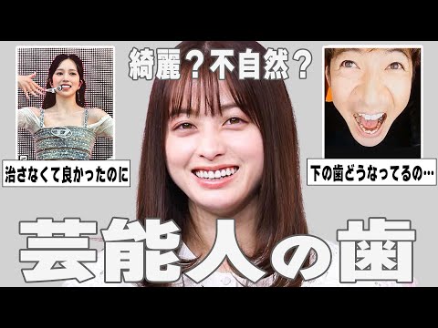 【ガルちゃん芸能】天然？セラミック？芸能人の歯を語ろう！【ゆっくり解説】